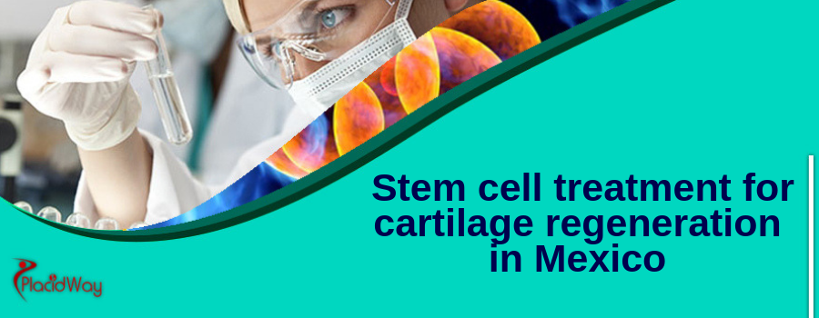 Stem cell treatment for cartilage regeneration in Mexico
